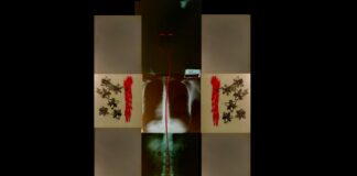 nella doto si vede un'opera d'arte con, al centro, un rigo di sangue su una radiografia del corpo umano. A destra e a sinistra due schizzi rossi e alcuni insetti verdi.