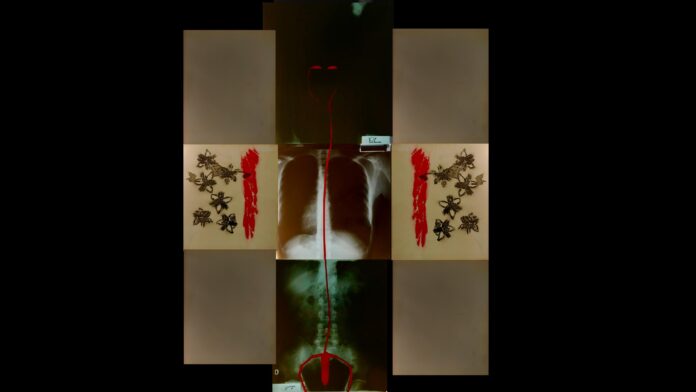 nella doto si vede un'opera d'arte con, al centro, un rigo di sangue su una radiografia del corpo umano. A destra e a sinistra due schizzi rossi e alcuni insetti verdi.