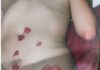 la foto a colori mostra una rosa rossa con gambo e l'immagine di parte di un corpo di donna dipinto con labbra rosse e dedica